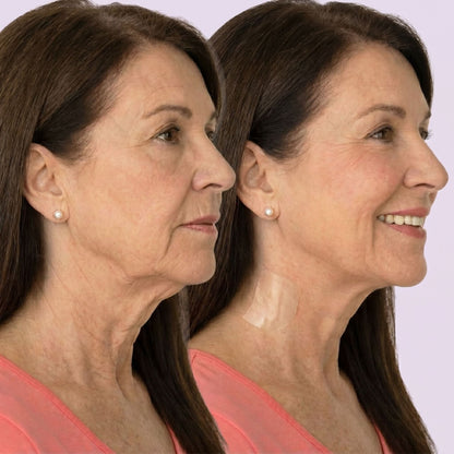 FlawSkin - Neck