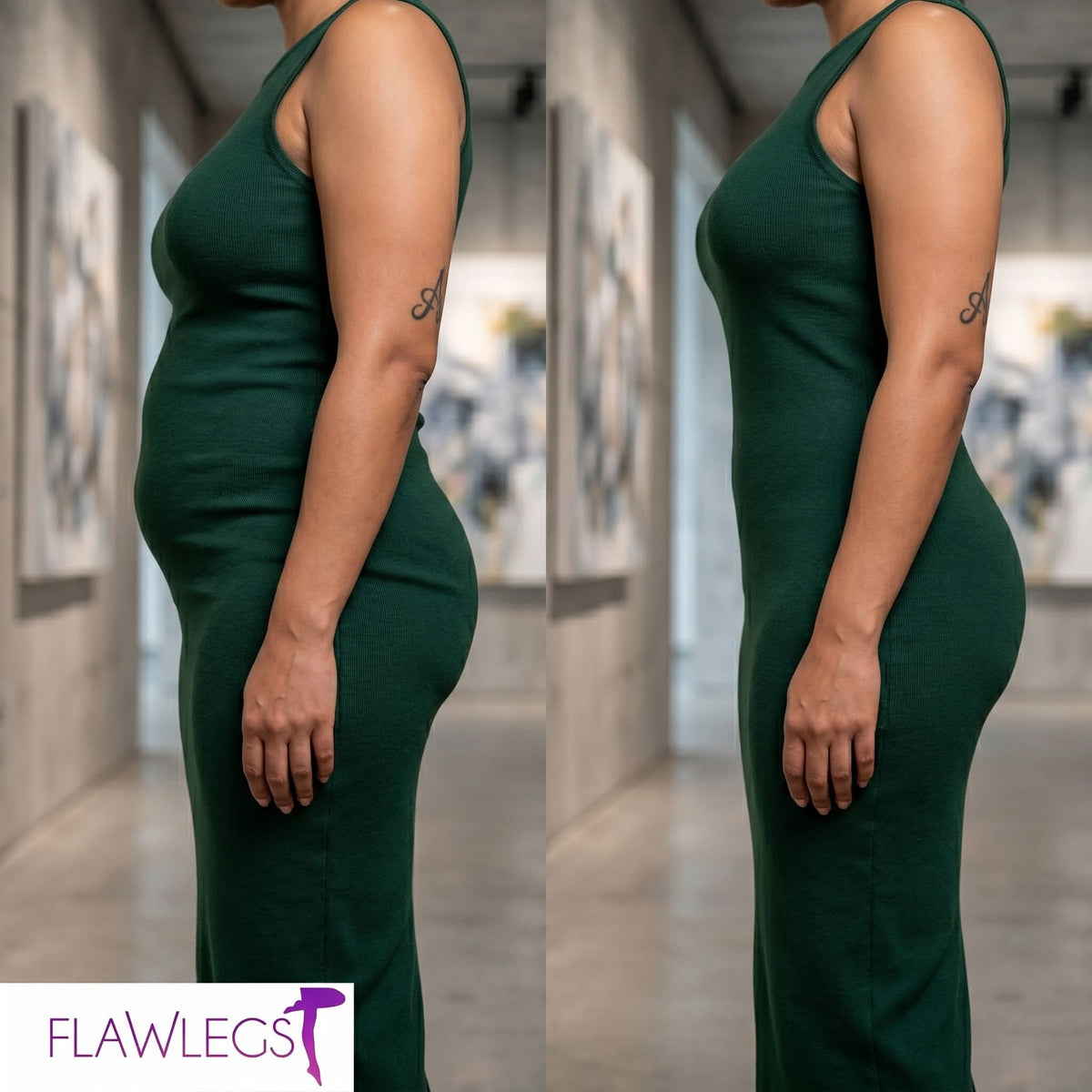 FlawSkin - Tummy
