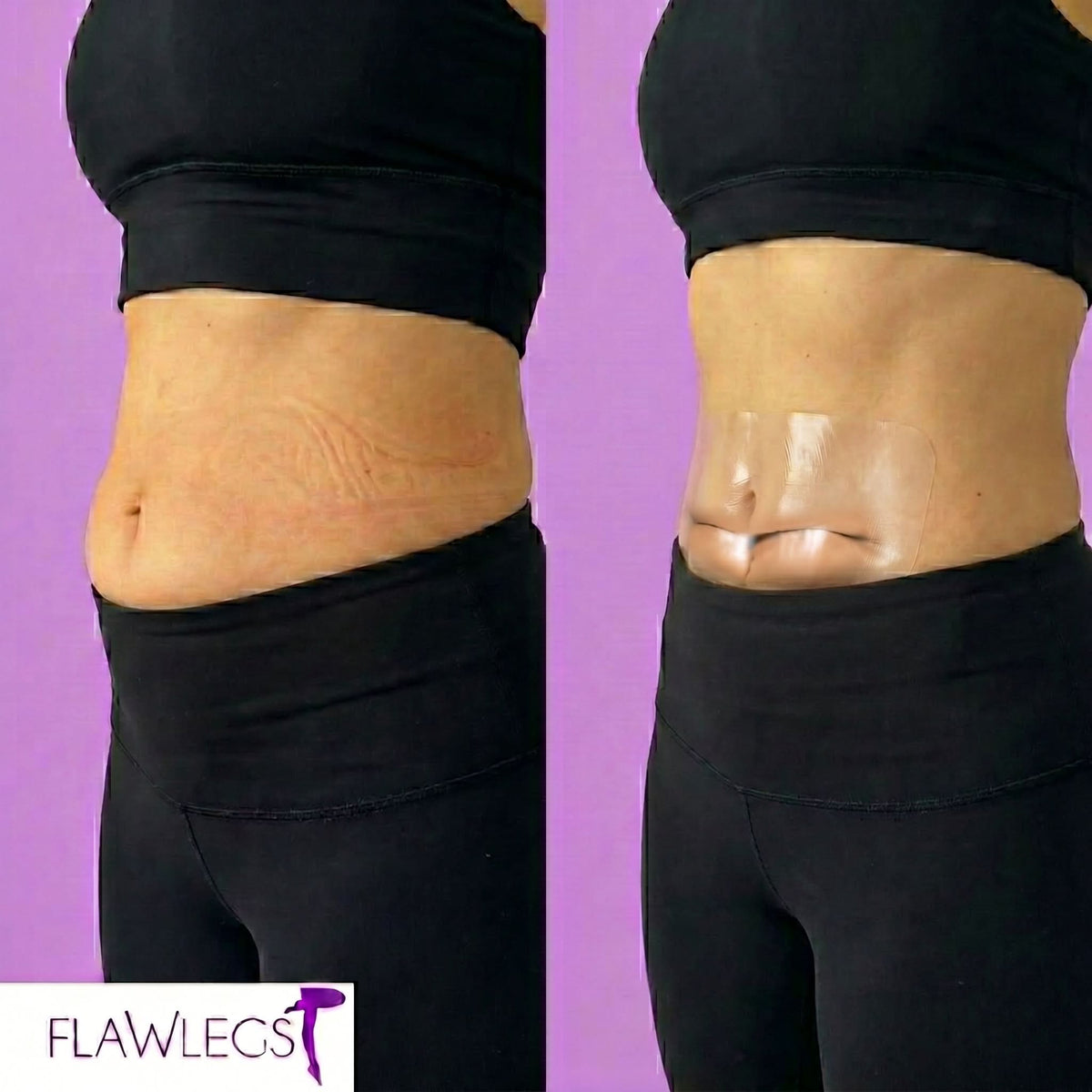 FlawSkin - Tummy